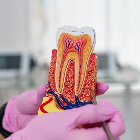 Root Canal Treatment